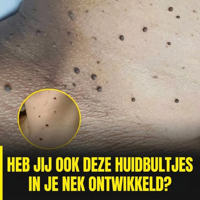 IMAGE ENHANCE DUTCH 202604181830 768x768